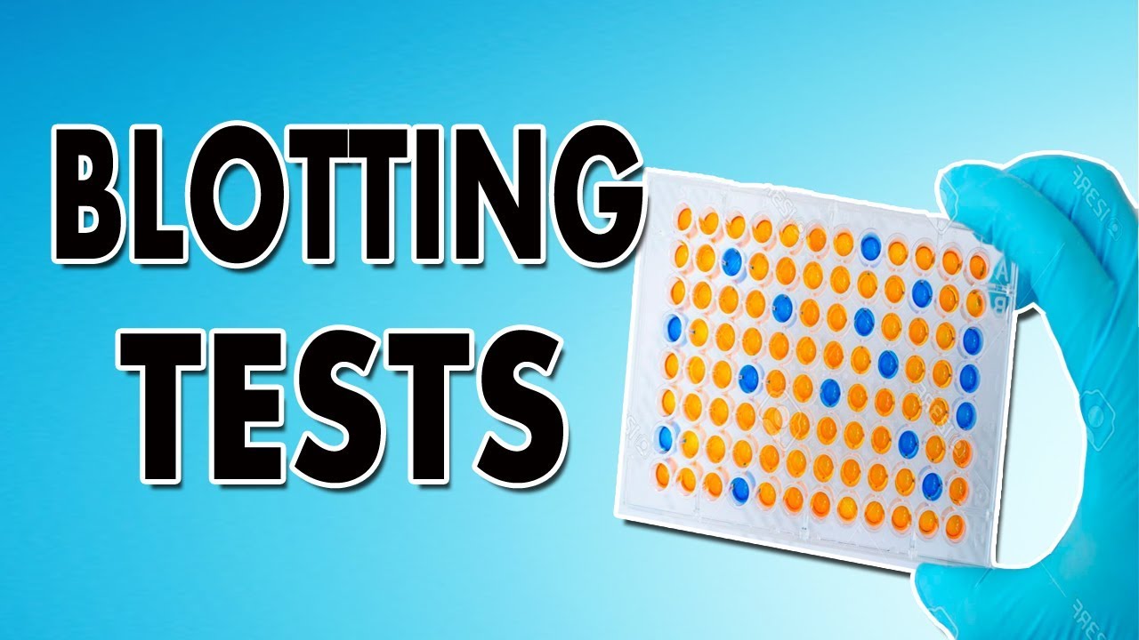 Blotting Techniques (Western Blot, Southern Blot and Northern Blot)