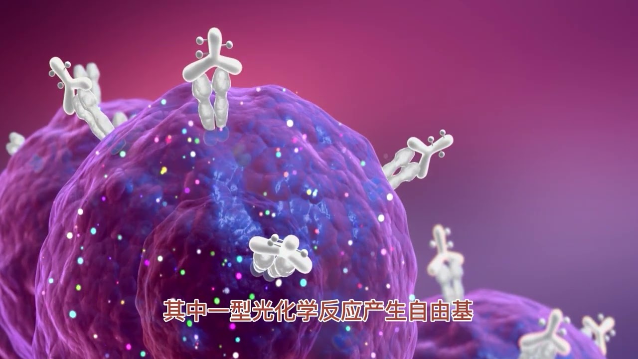 光动力治疗癌症