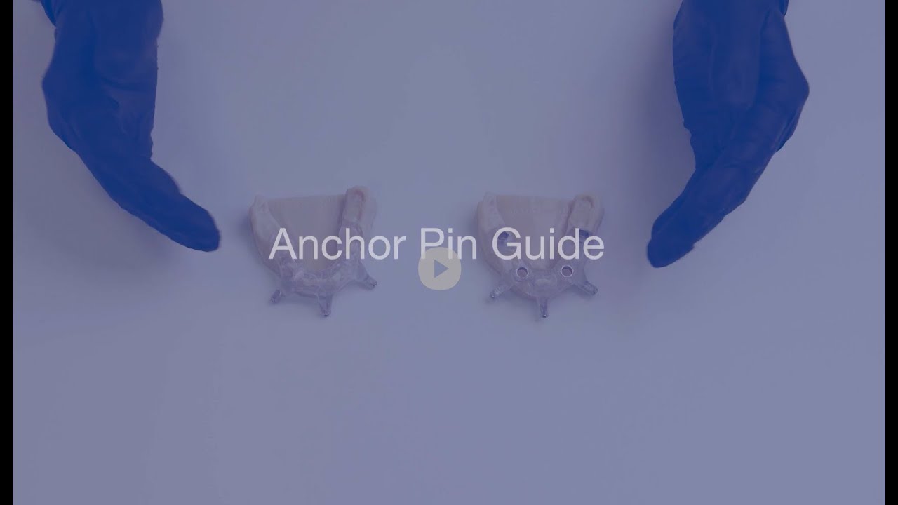 Anchor Pin Guide