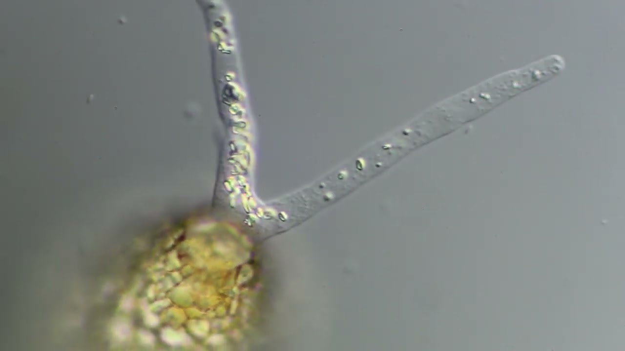 Crystals in the pseudopods of a Difflugia testate amoeba