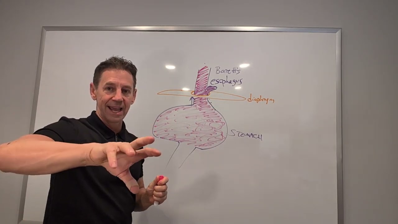 Is Surgery Your Only Option for a Hiatal Hernia?