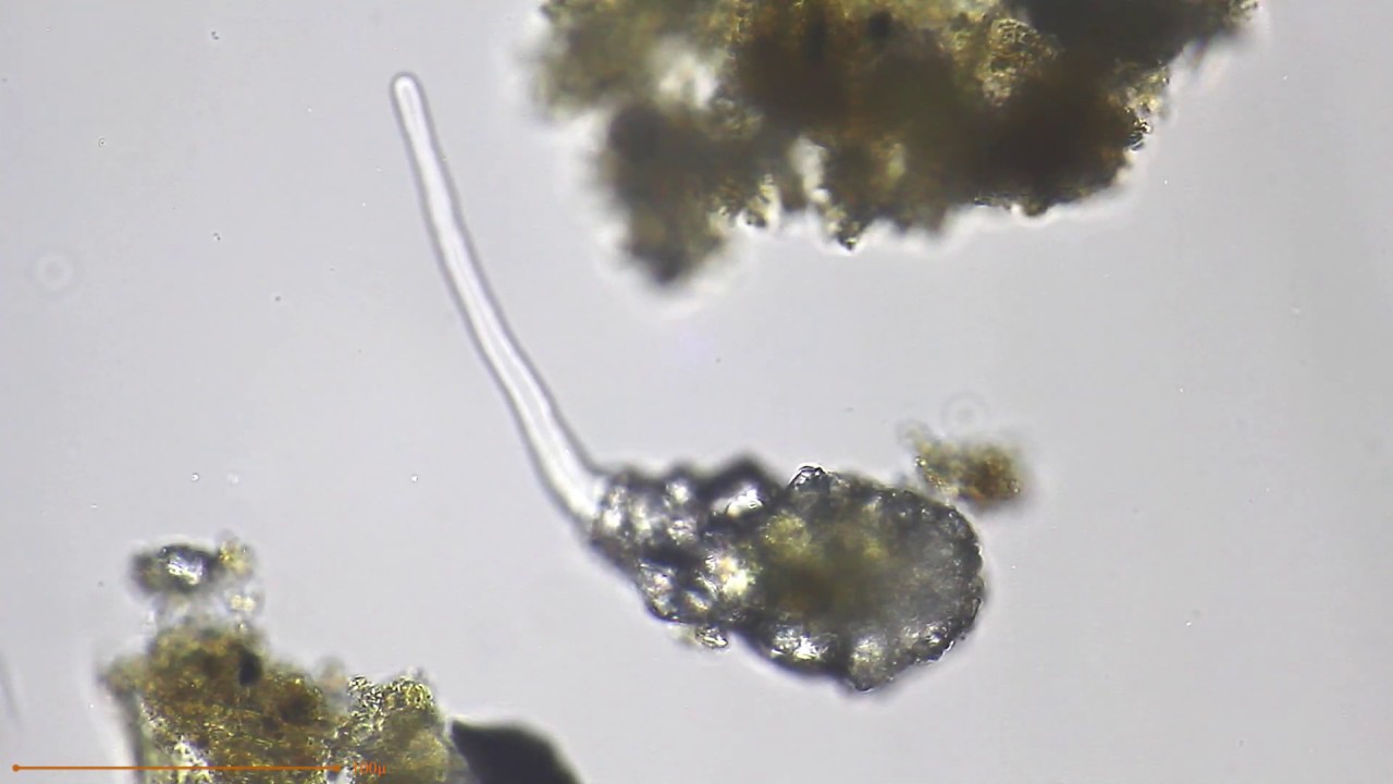 Testate Amoeba (Difflugia pyriformis) Microscopy