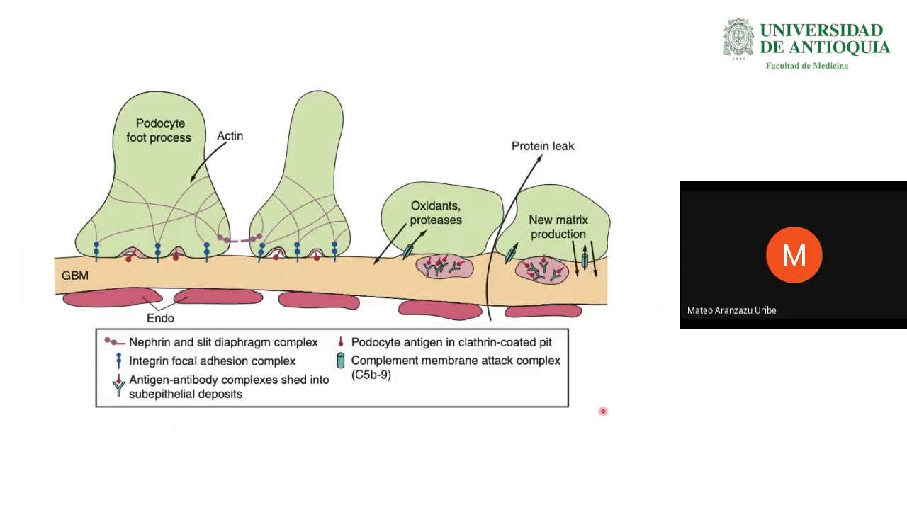 Nefropatía Membranosa y Glomerulonefritis Membrano Proliferativa - Dr. Mateo Aranzazu