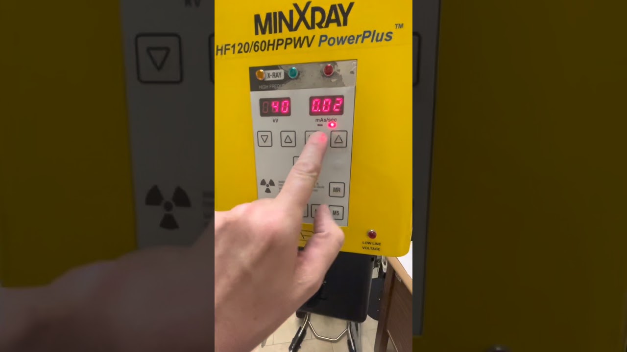 Портативная рентгеновская система MinXray