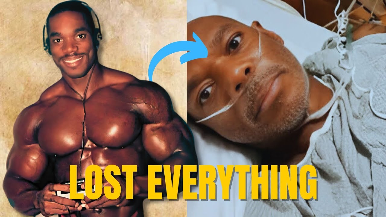 Flex Wheeler: The SAD STORY From a PERFECT Physique To LOSING a LEG