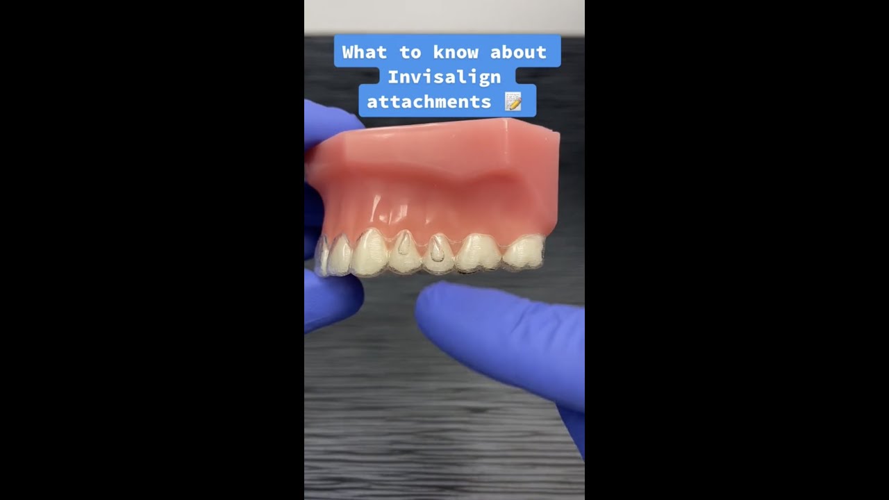 Invisalign Attachments Explained!