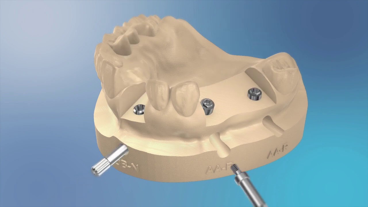 Flusso digitale Model Creator Exocad con IPD ProCam