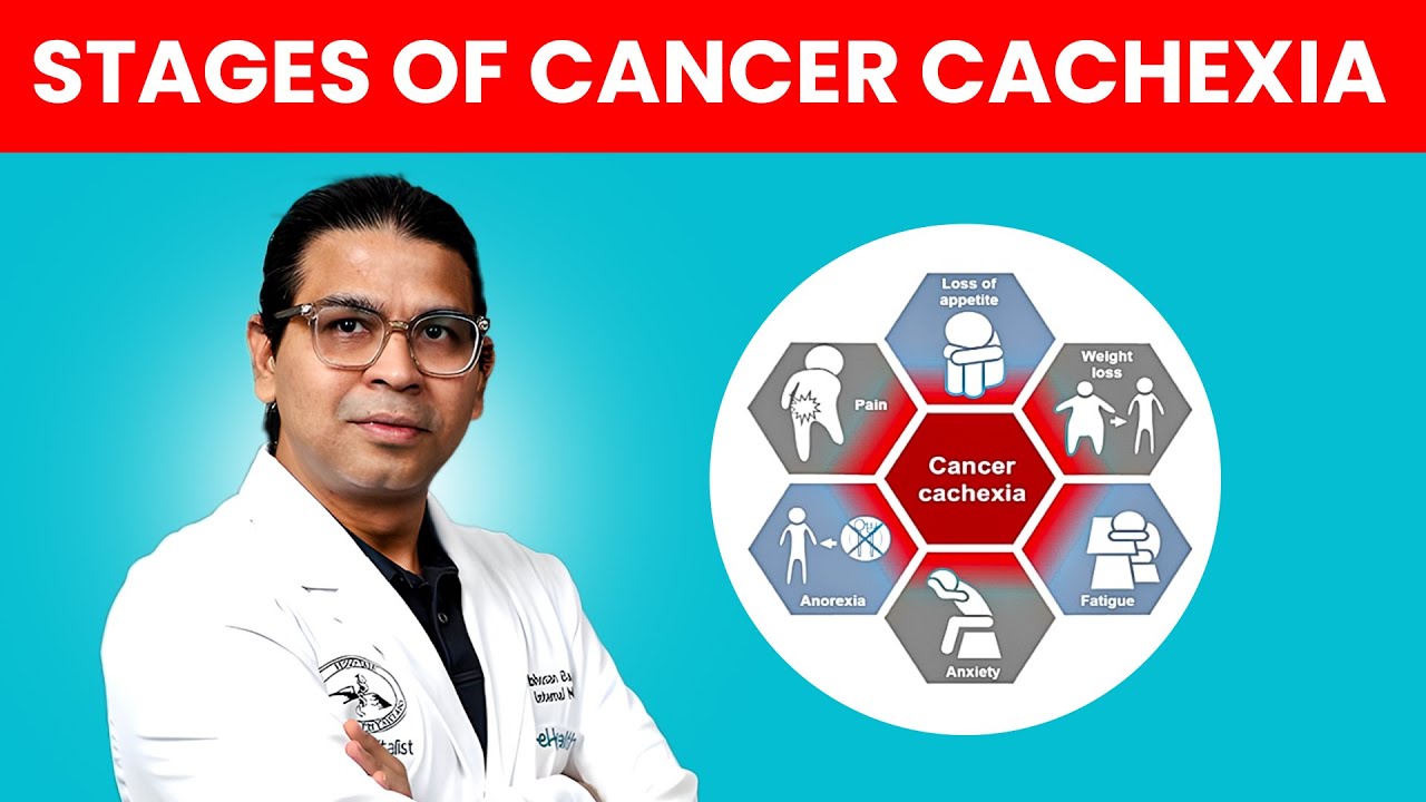 Stages of Cancer Cachexia Explained | Pre-Cachexia, Cachexia and Refractory Cachexia