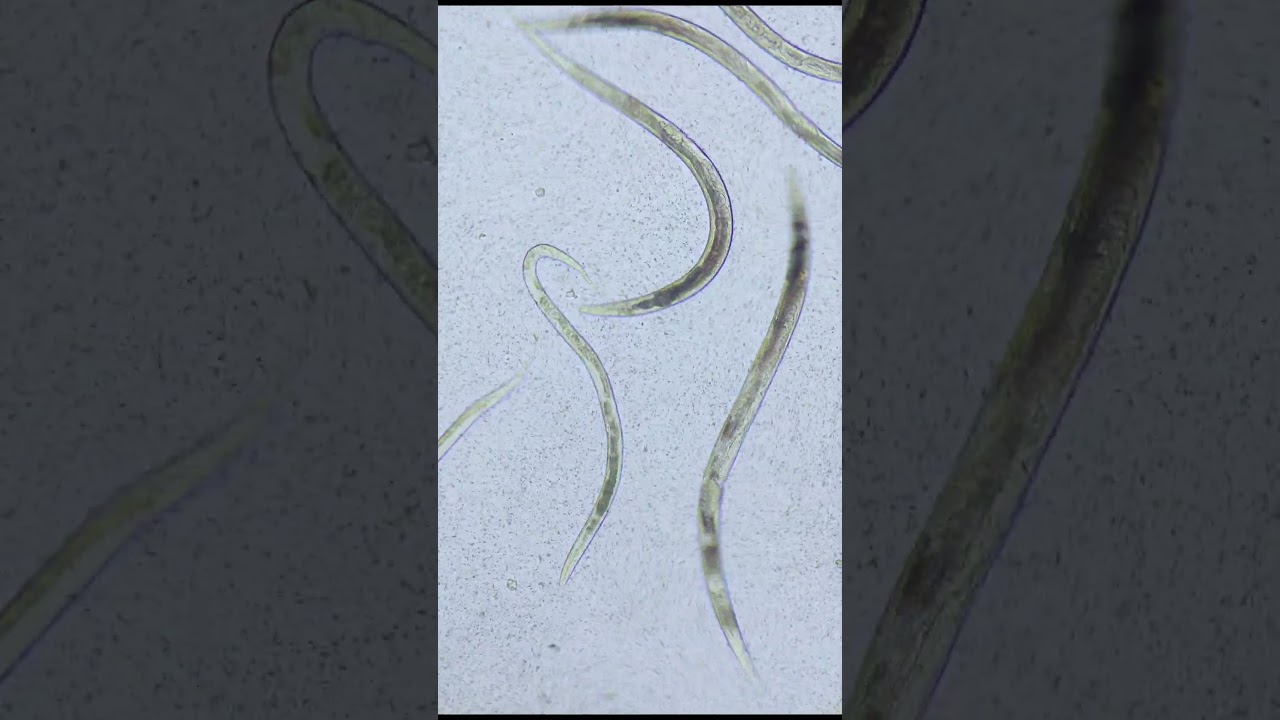 Albendazole and human parasites | TULO - Microscope