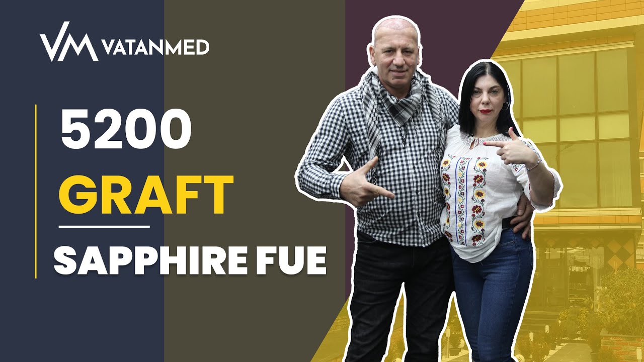 Story cu transplant de păr | ROMÂNIA