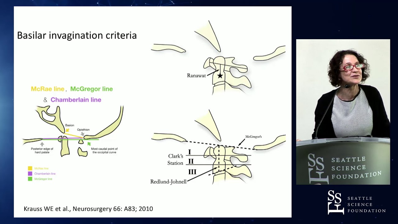 Inflammatory, mass-like and masses at the cranio-cervical junction - Wendy Cohen, M.D.