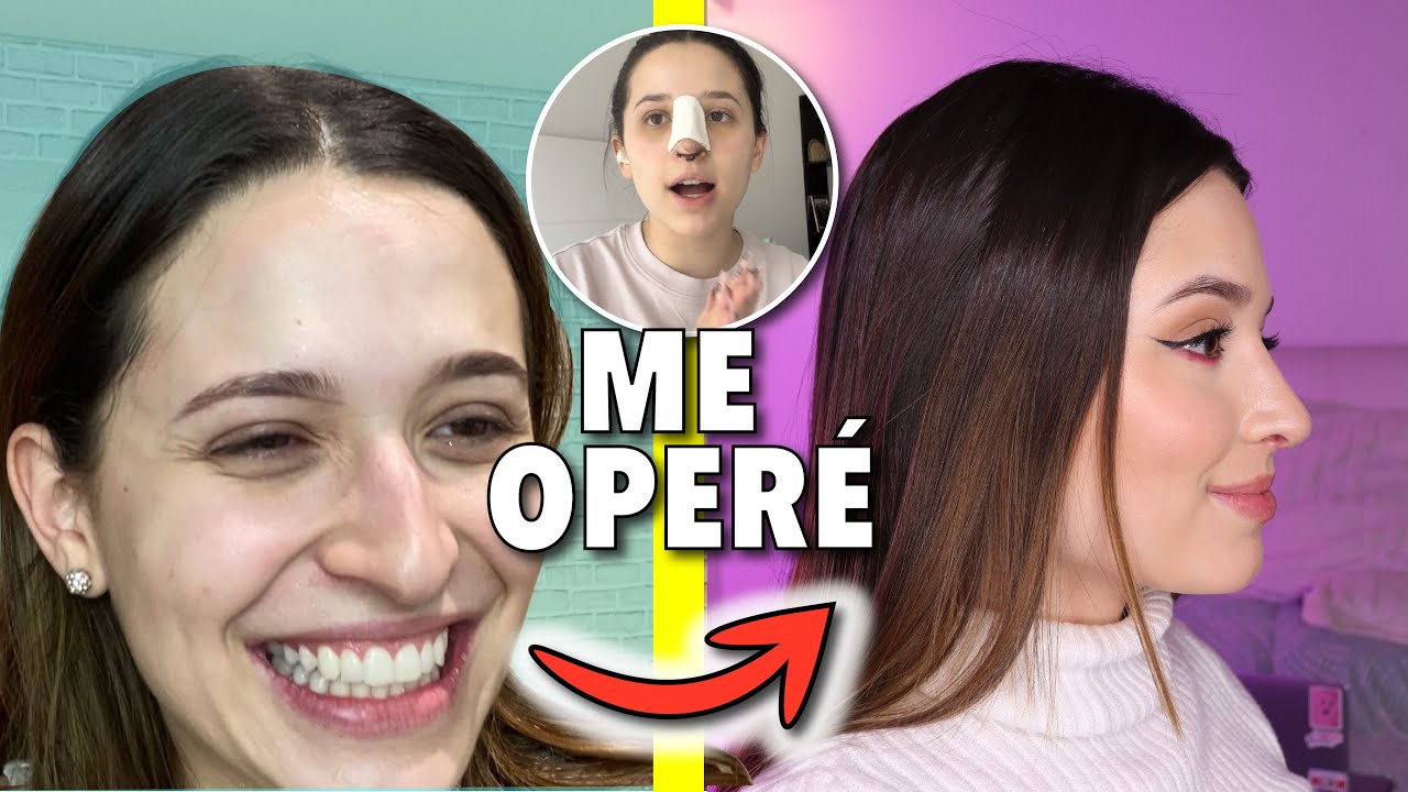 ANTES Y DESPUÉS DE MI CIRUGIA DE NARIZ *así quedó realmente* | Laura Mejia