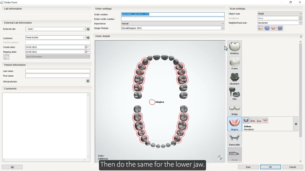 Creating an order for partial denture and full denture in Dental System