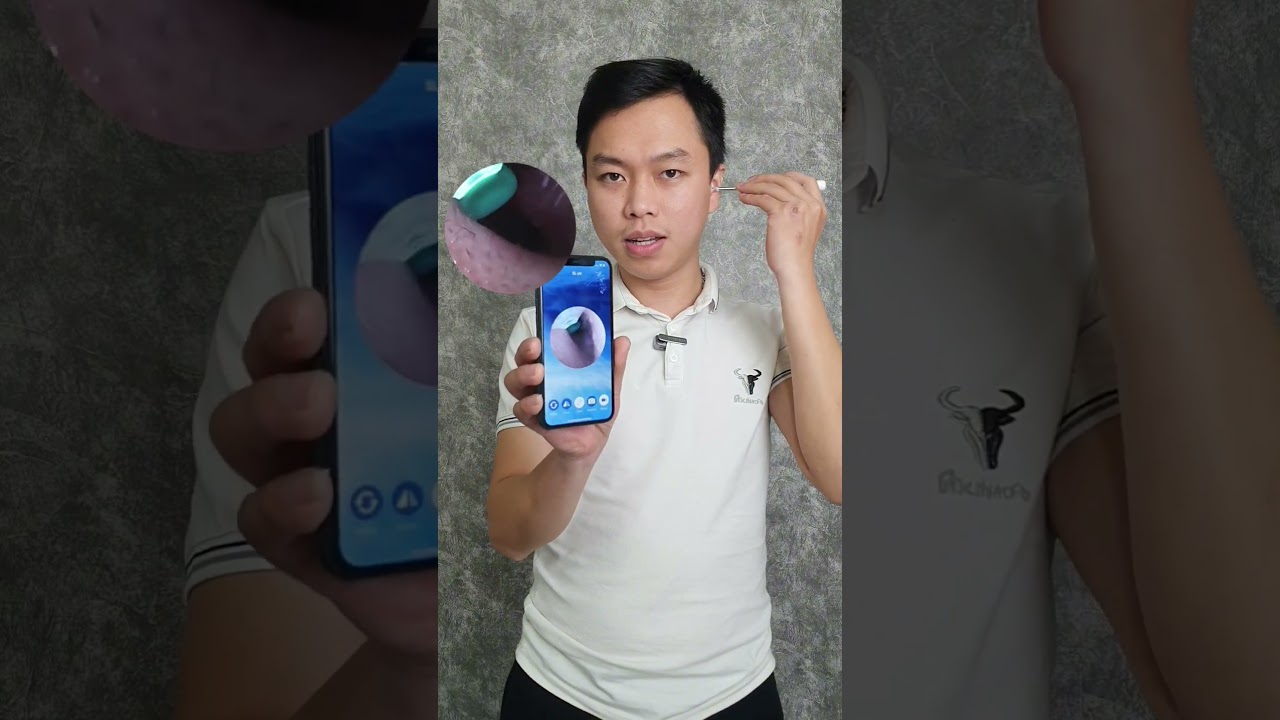 máy lấy ráy tai thông minh FIKO NE3 PRO 