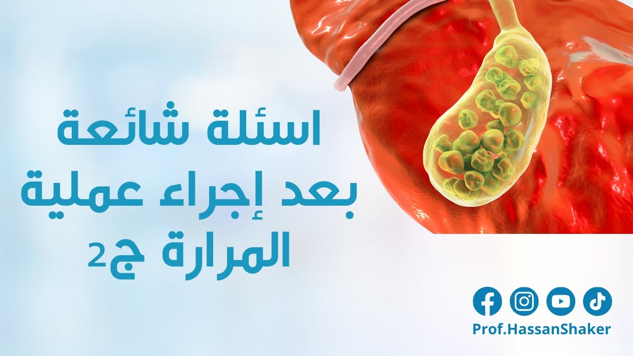 اسئلة شائعة بعد إجراء عملية المرارة ج2