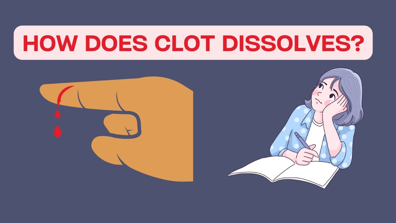 FIBRINOLYSIS EXPLAINED! (SUPER CLEAR!)