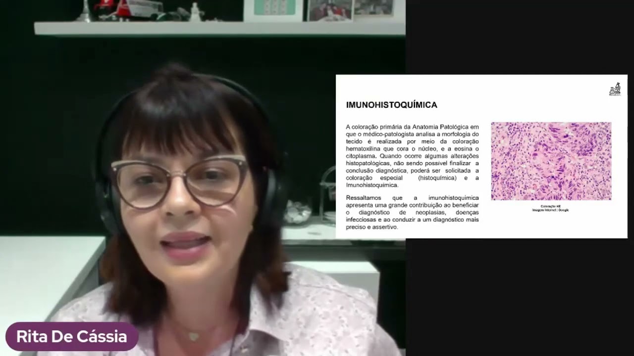 Imuno-histoquímica - Rita de Cássia A.M.G Pinto