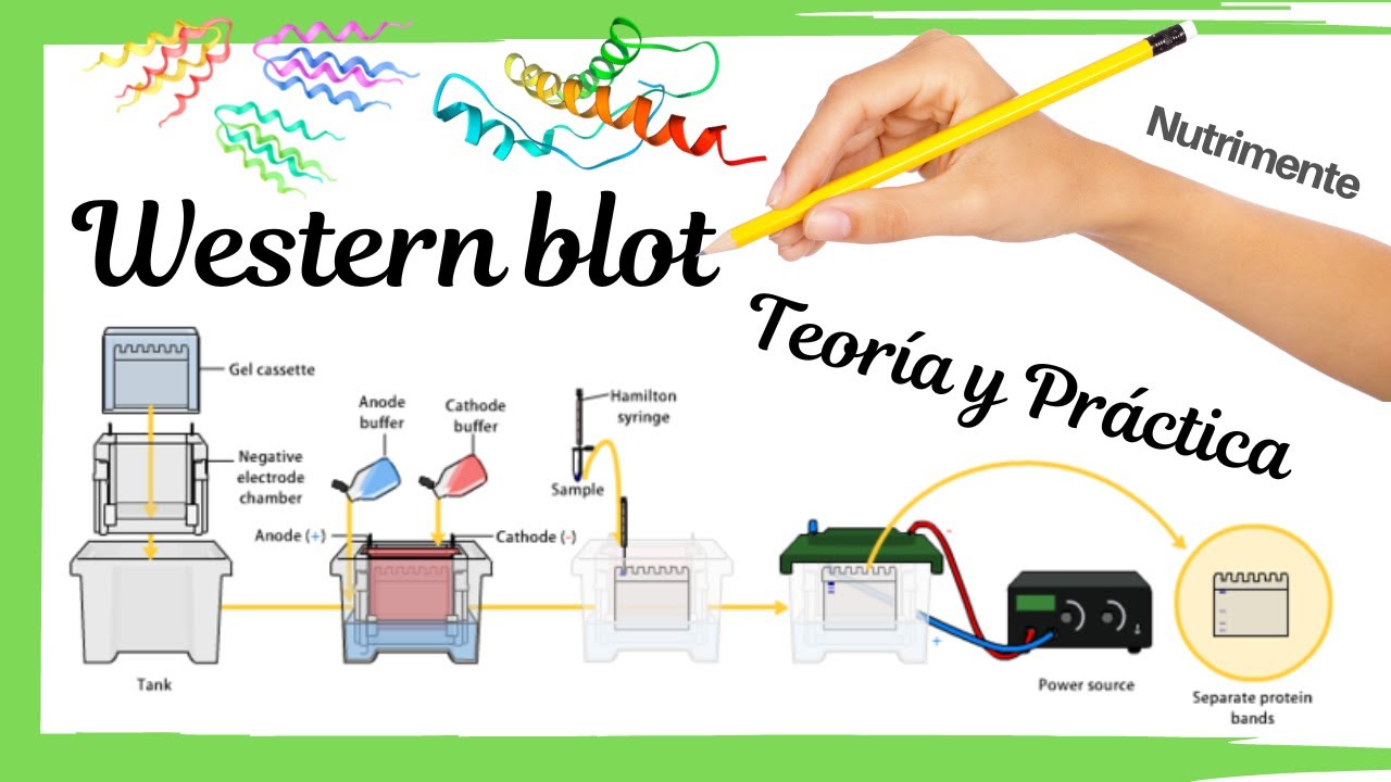 Western blot [Teoría y Práctica]