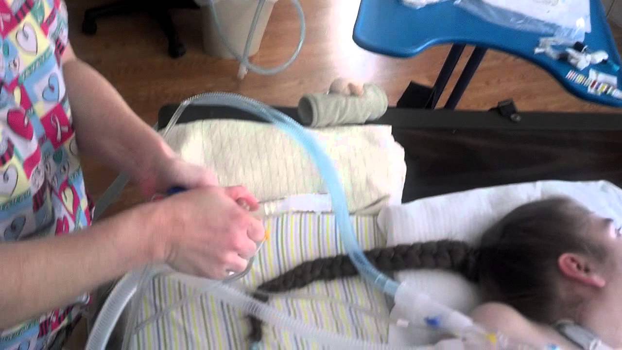 Changing a pediatric ventilator circuit