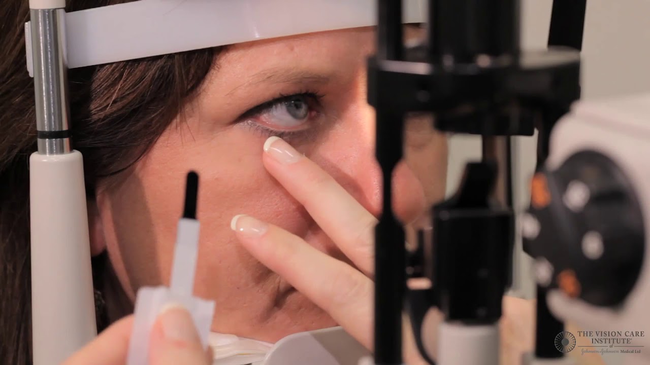 Slit Lamp Techniques   Lissamine Green
