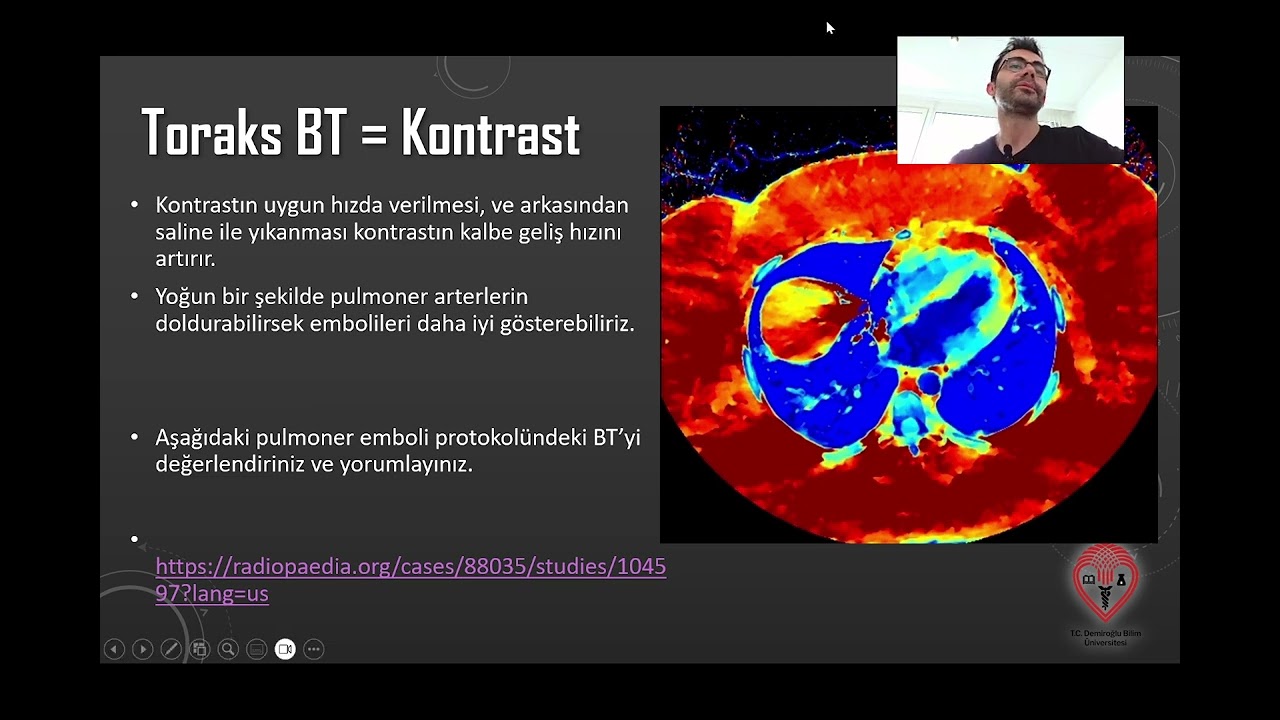 Görüntüleme Teknikleri BTMR 7   Torakoabdominal Radyoloji