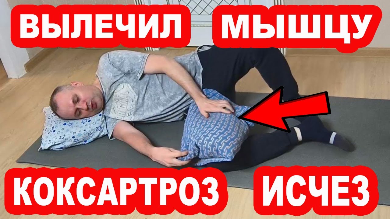 Вылечи эту мышцу и КОКСАРТРОЗА не будет НИКОГДА! Забудь о боли в тазобедренном суставе!