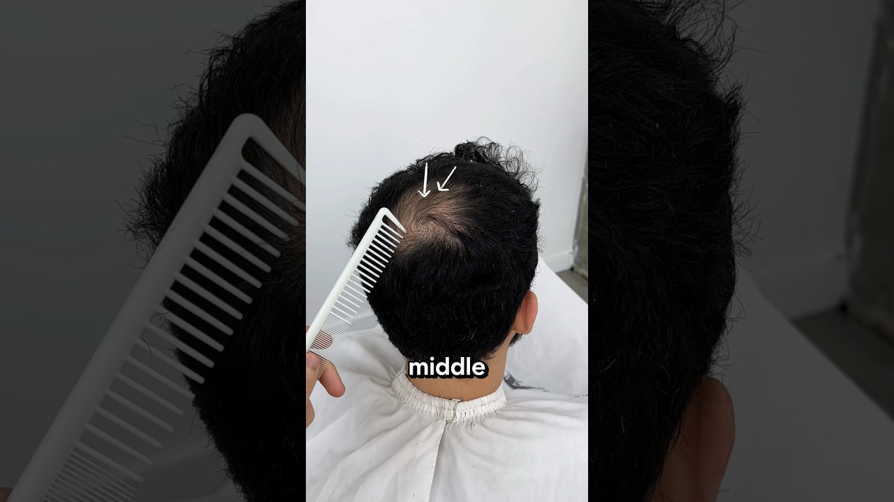 How I fix a BALD spot!