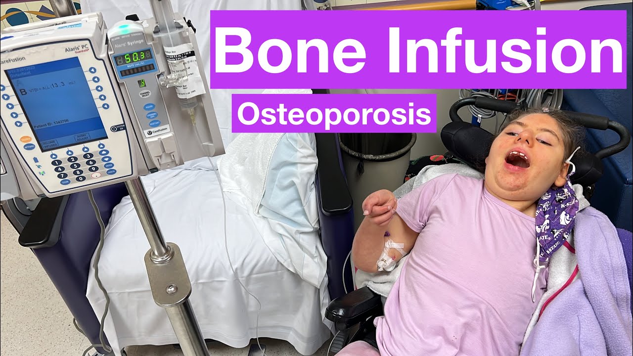 EASIEST Bone Infusion Appointment EVER!