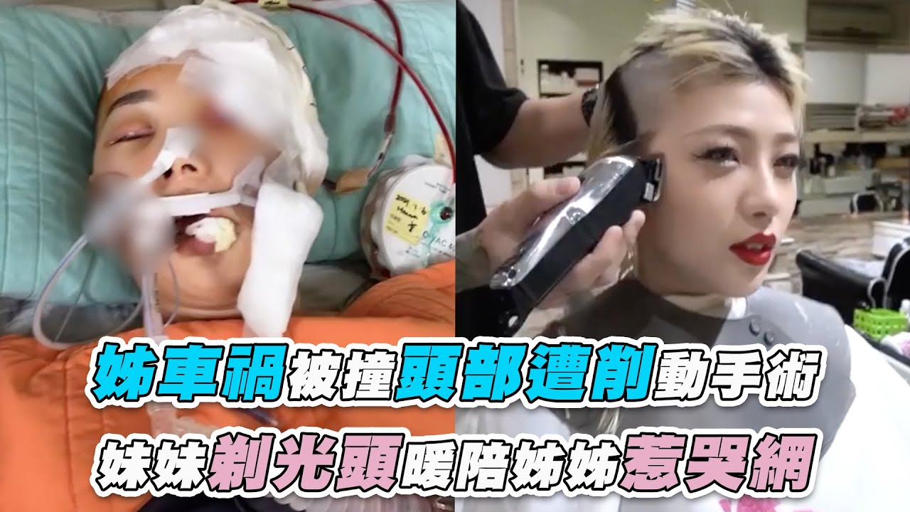 【姊騎車被撞頭部遭削動手術 妹妹剃光頭暖陪姊姊惹哭網】｜@ms.johnny2.043