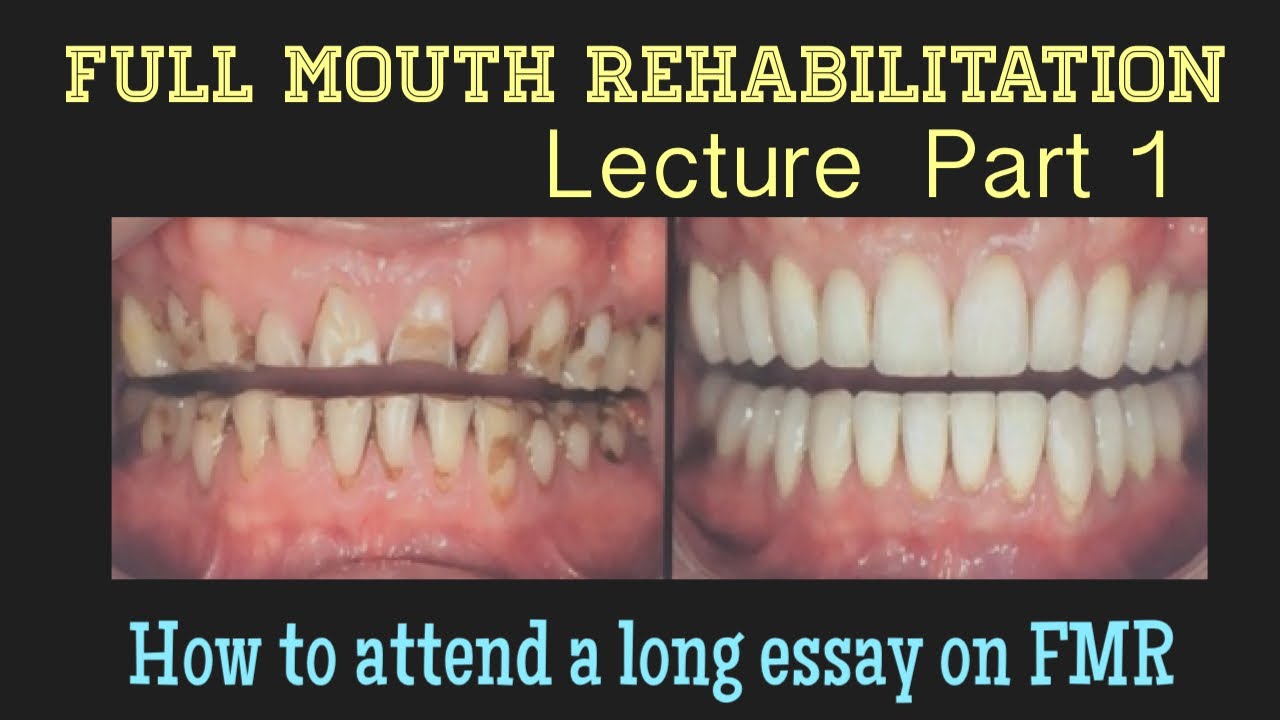 Full mouth rehabilitation lecture part 1
