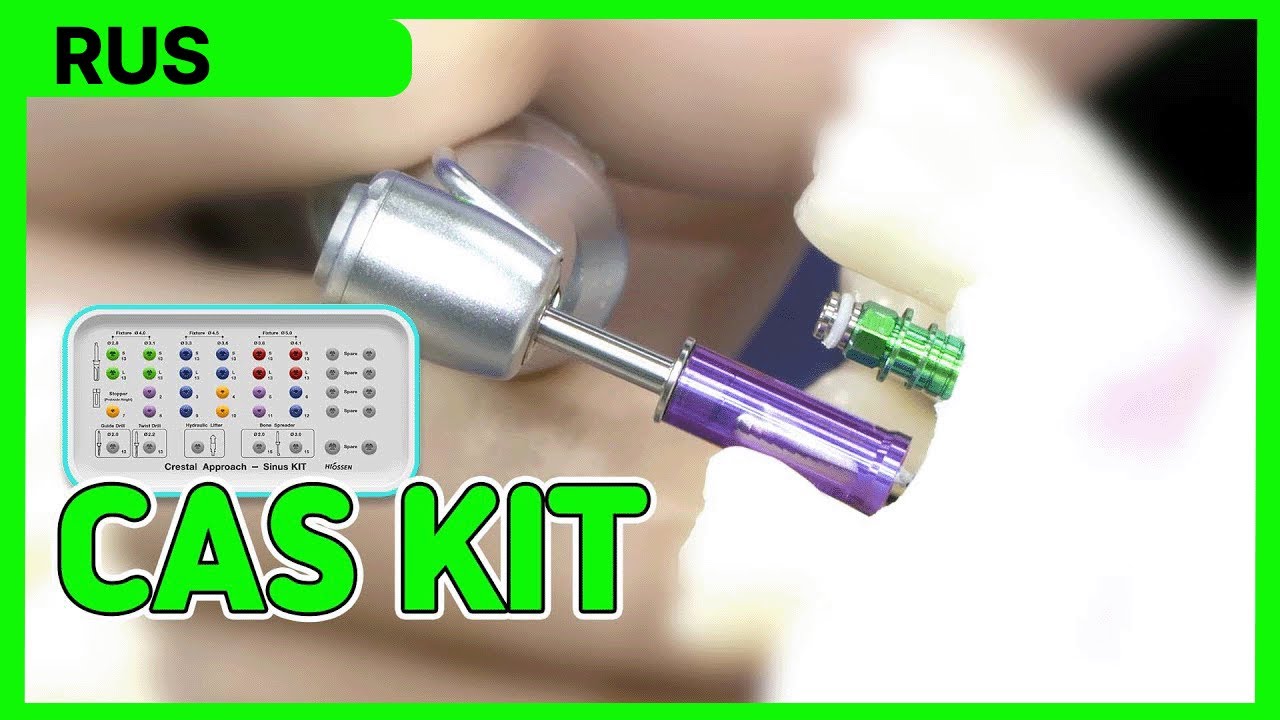 [Практические советы] CAS KIT - Имплантация в области зубов #25, #26