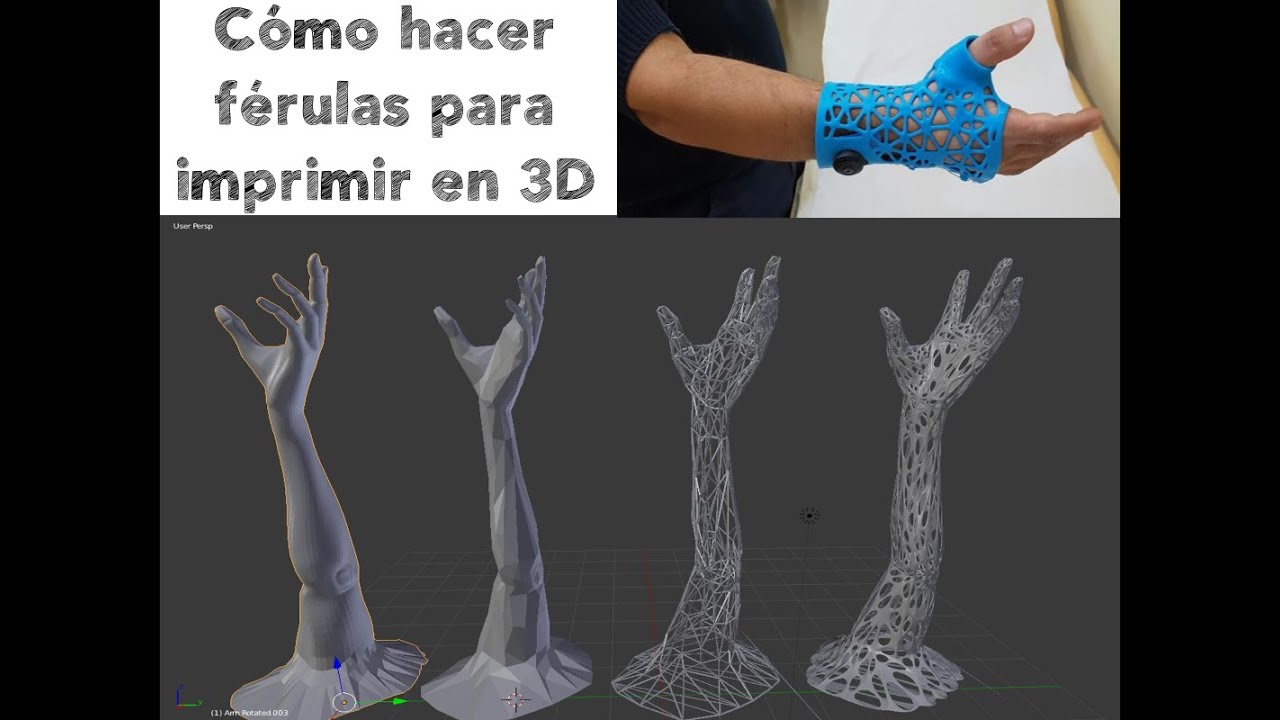 Cómo elaborar Férulas con impresión 3D (parte1)