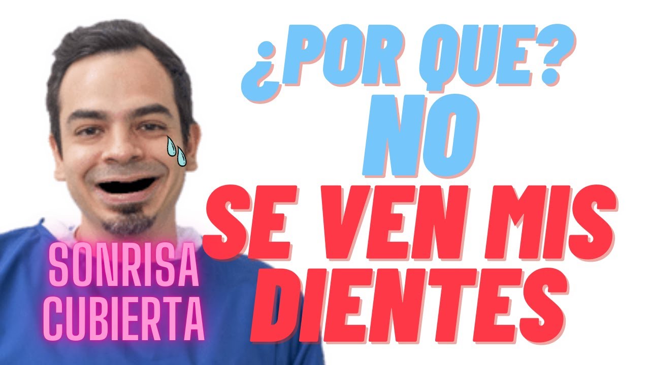 Sonrisa SIN Dientes / ¿Por qué no se ven los dientes al sonreír? | SONRISA CUBIERTA