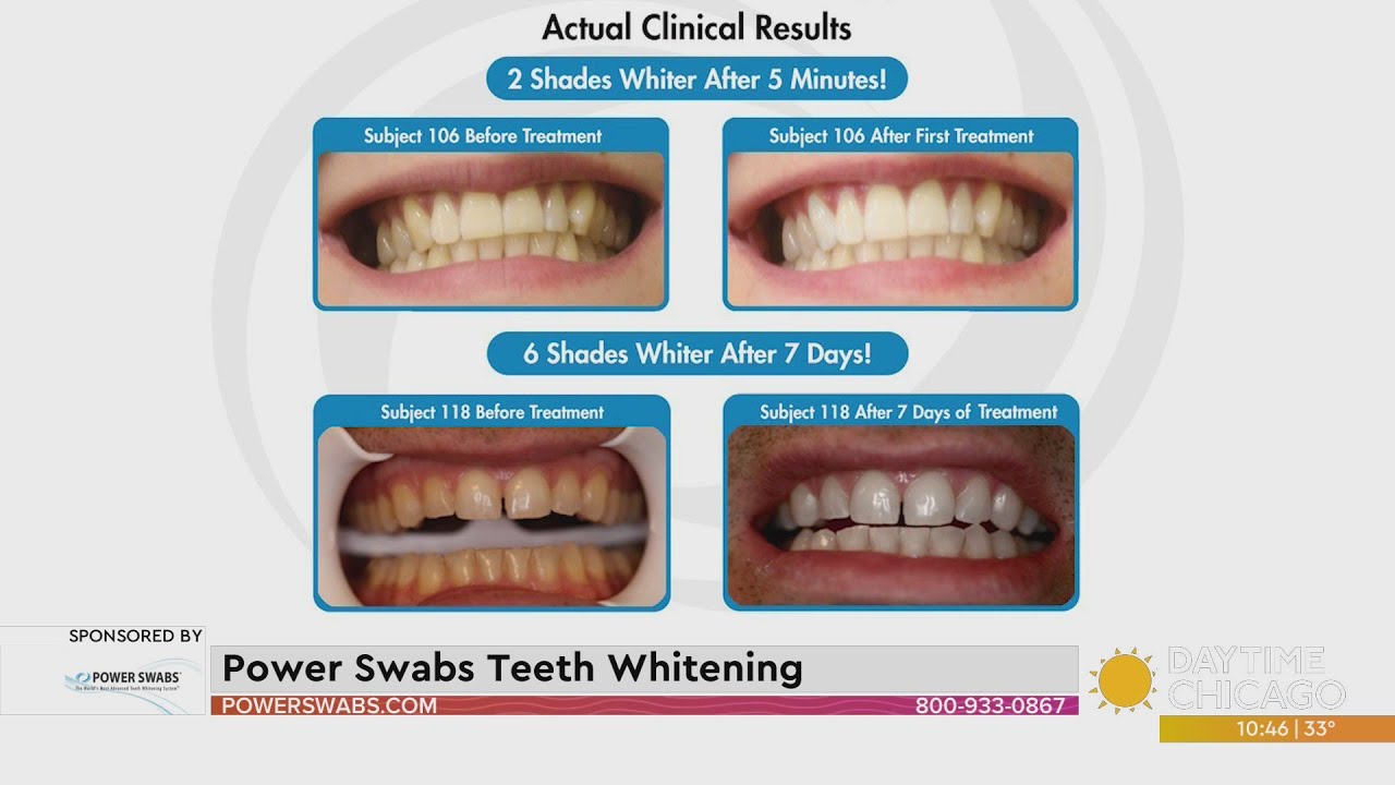 Power Swabs Teeth Whitening