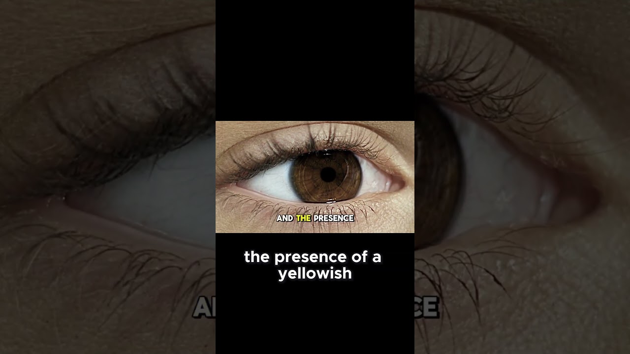 The Rarity of Green Eyes Explained! 