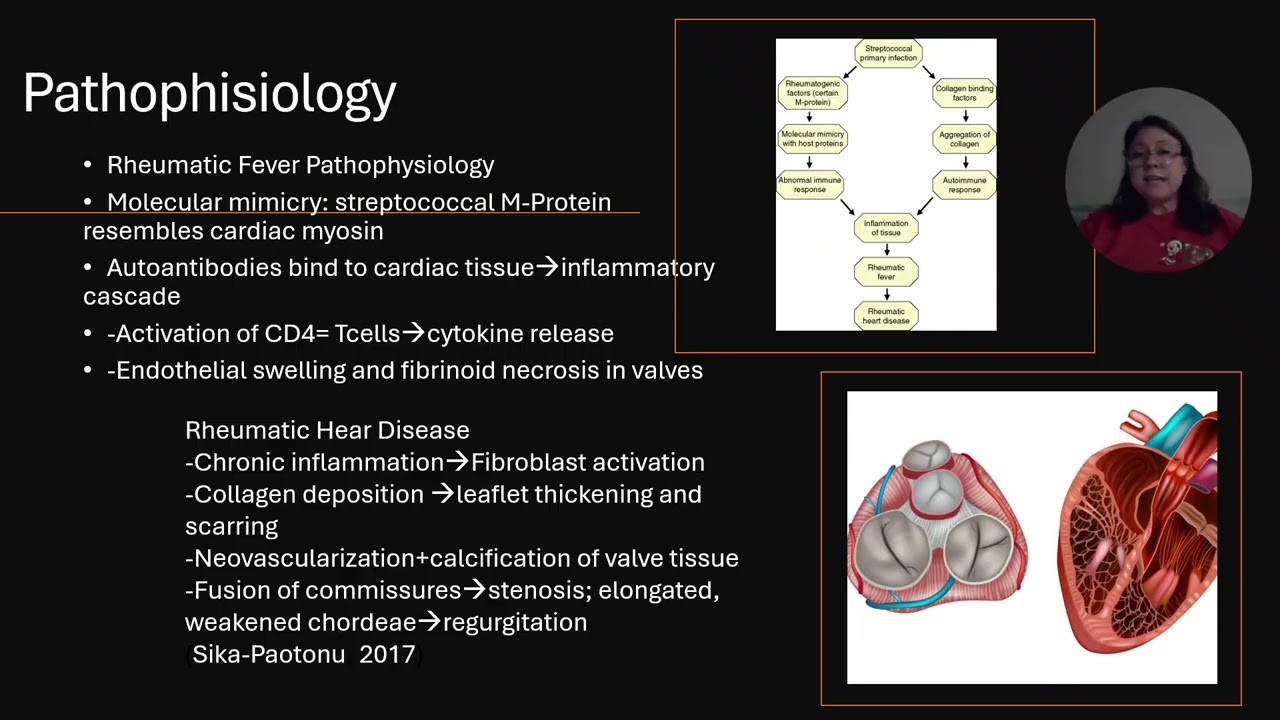 Case 10  Rheumatic Fever and Rheumatic Heart Disease