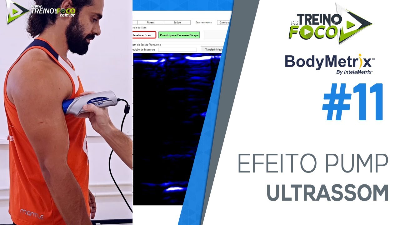 Pump após 6 séries de Rosca Direta analisado com Ultrassom - Bodymetrix #11
