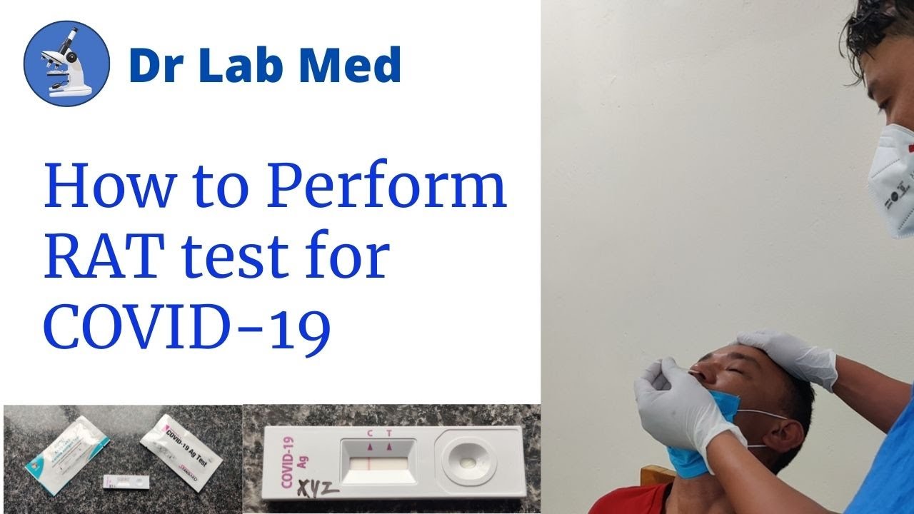 Rapid Antigen Test for Covid-19 : Procedure explained using Nasopharyngeal Swab.