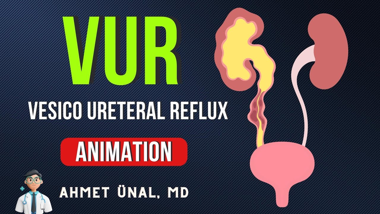 🎬 VUR (Vesico Ureteral Reflux) CLASSIFICATION & ANIMATION