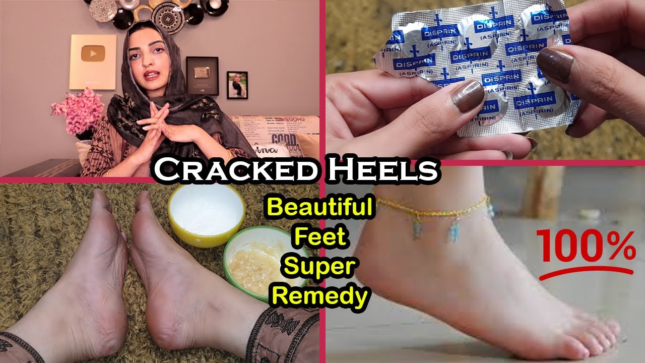 Get Beautiful Soft Feet & Cracked Heels Removal Super Home Remedy with Disprin & Baking Soda