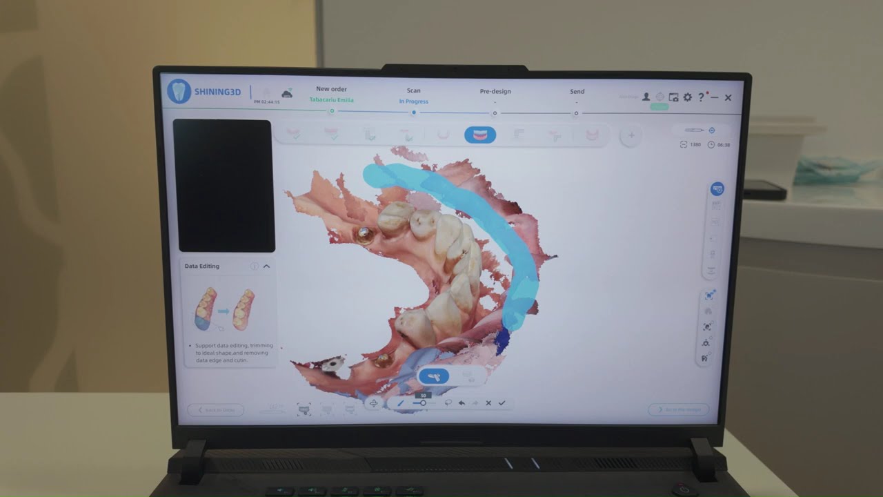 Aoralscan Elite - Shinning 3D