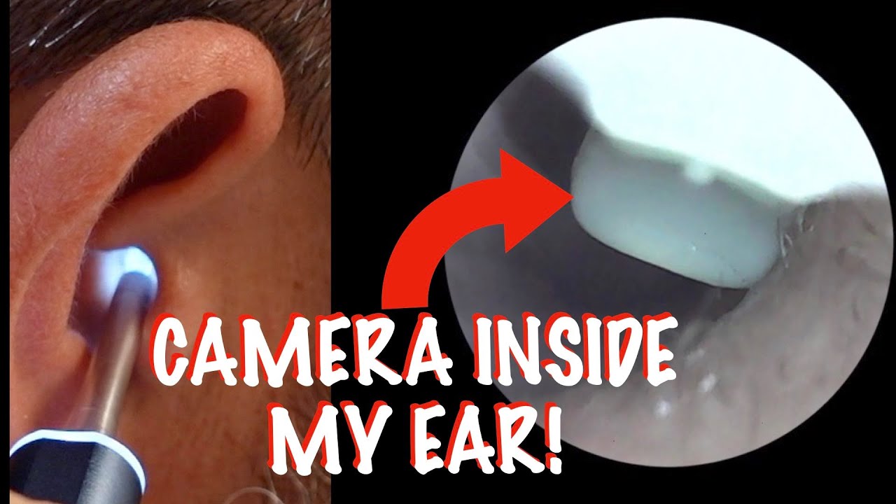 SPADE from Axel Glade Review | The Smartest Ear Care Kit