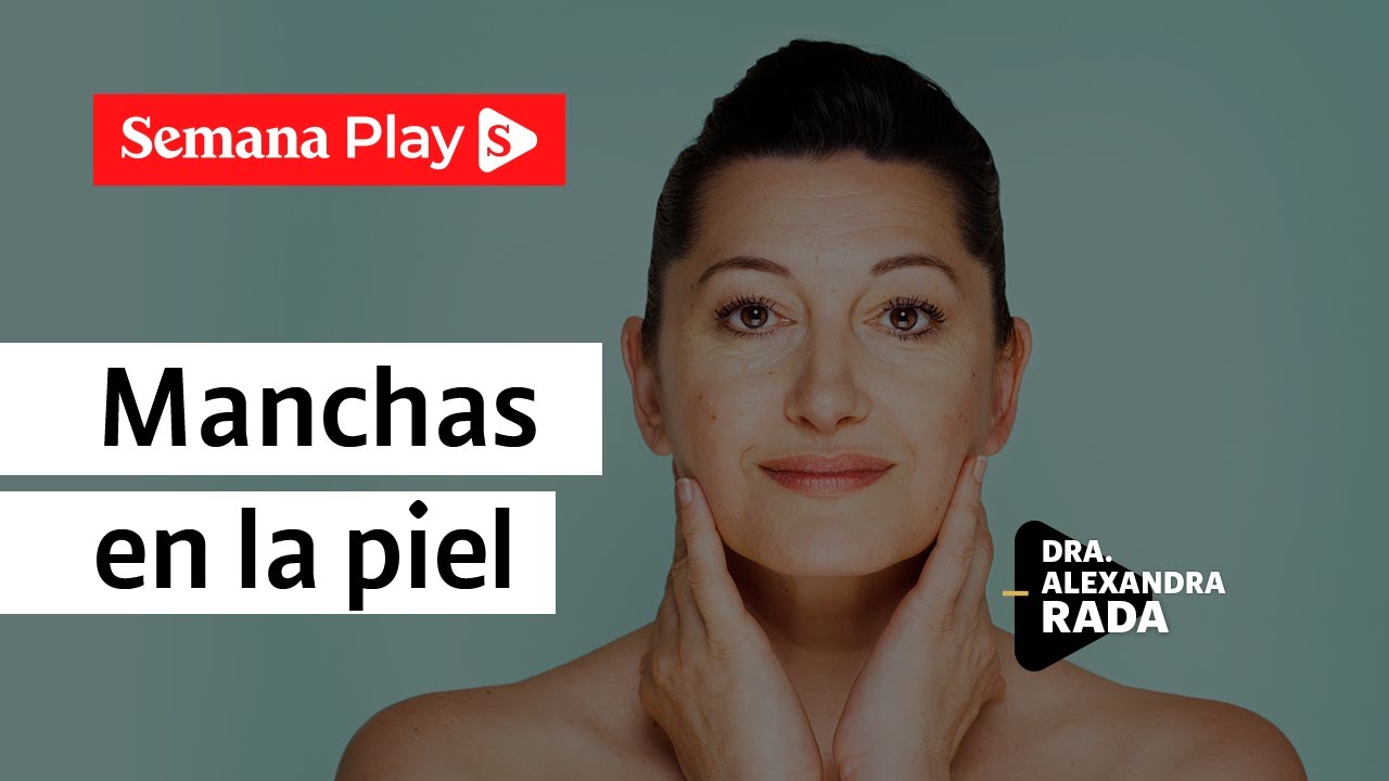 Manchas en la piel: causas y tratamientos | Alexandra Rada en EstéticaMENTE