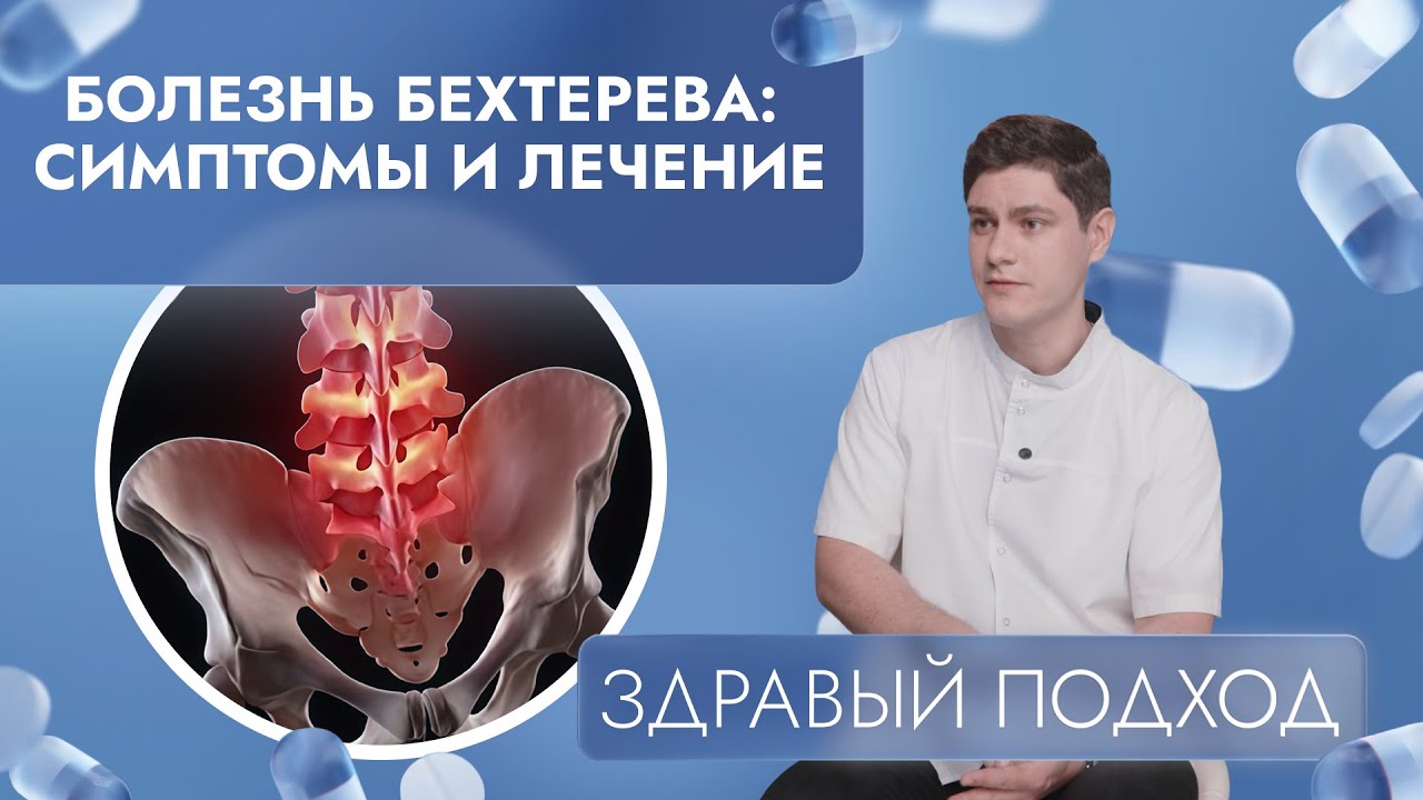 Болезнь Бехтерева: симптомы и лечение | Здравый подход (2025)