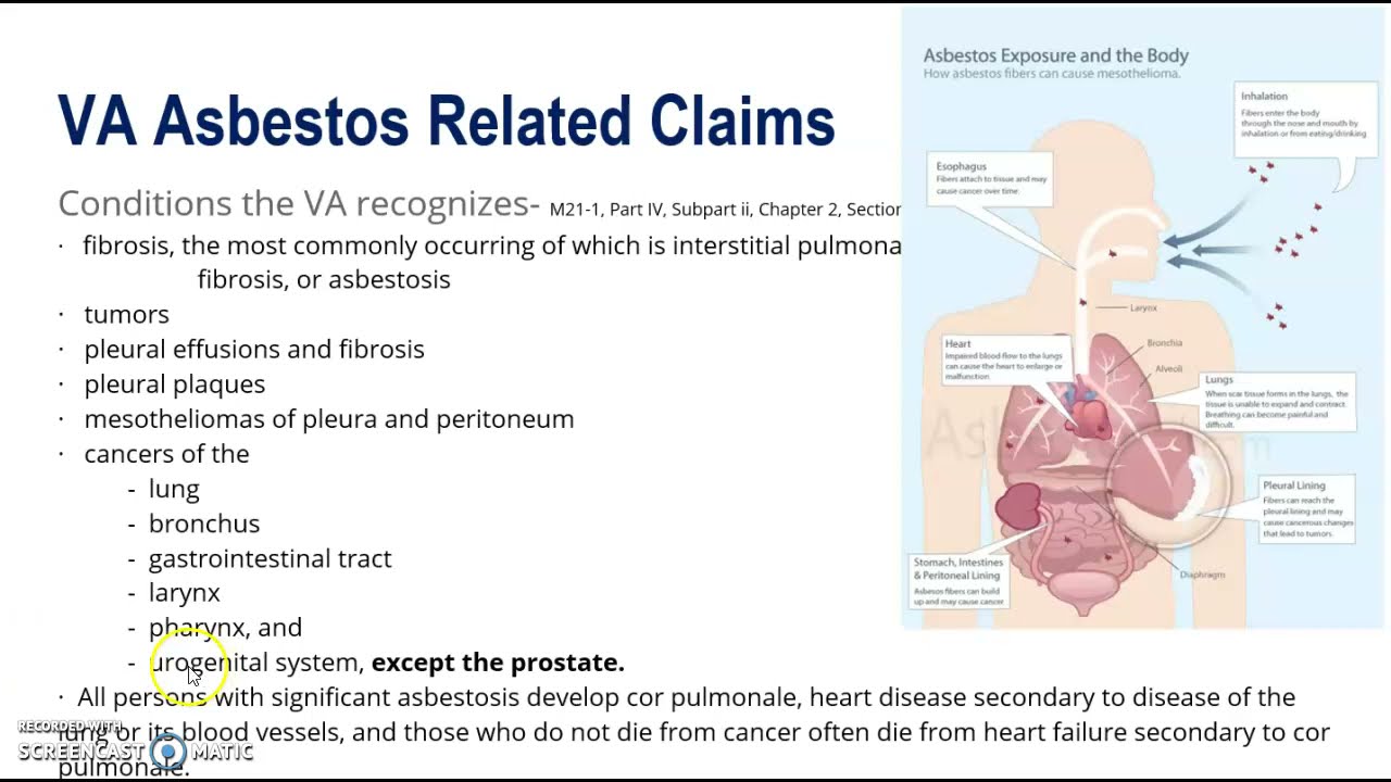 Components of Asbestos Disease for VA Claims