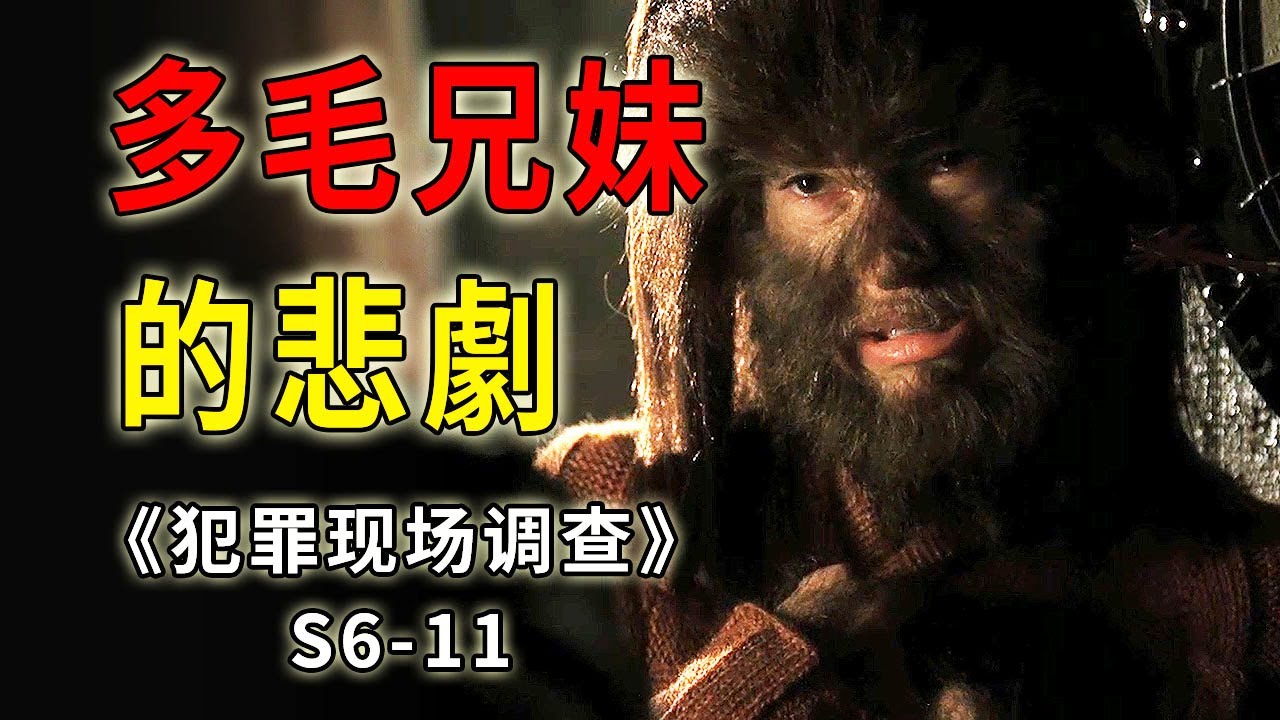 多毛症女孩模樣可怖，躲在密室二十年如同隱形人《C.S.I.--Crime Scene Investigation 》