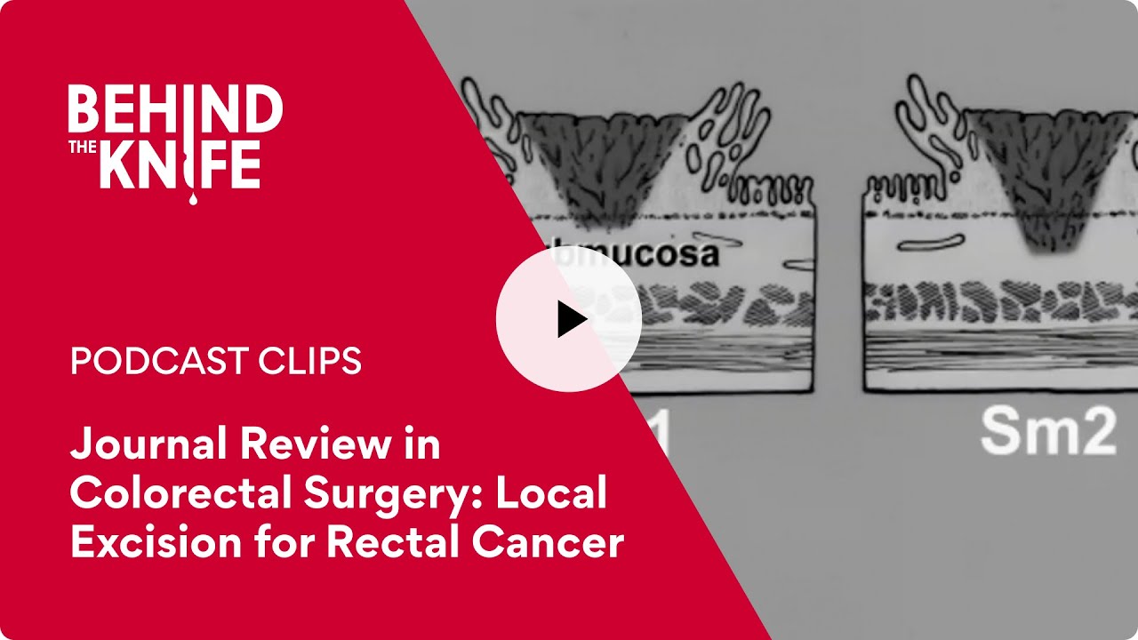 Journal Review in Colorectal Surgery Local Excision for Rectal Cancer