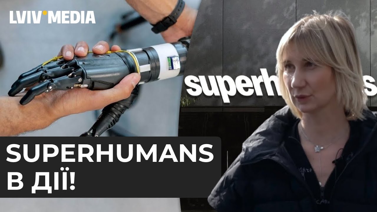 Як виглядає  Superhumans Center / Екскурсія по клініці травм війни