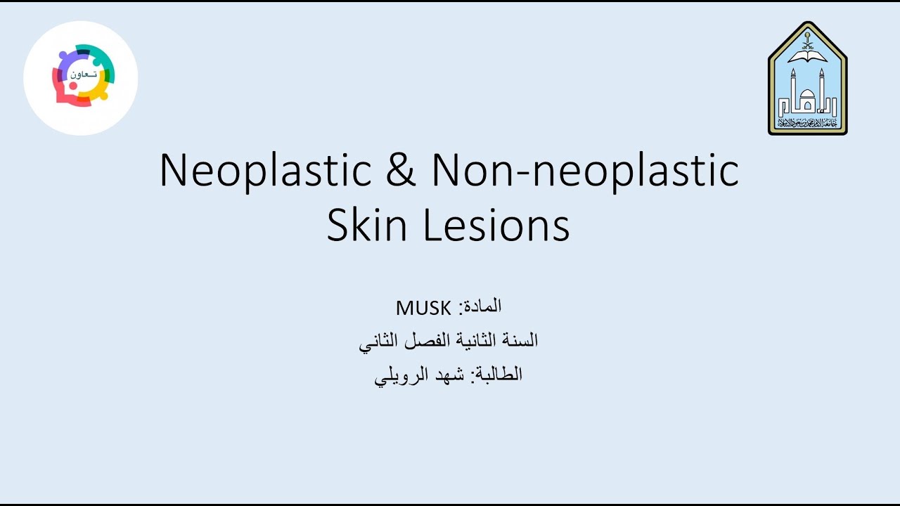 | Neoplastic & Non-Neoplastic skin Lesions | الطالبة: شهد الرويلي