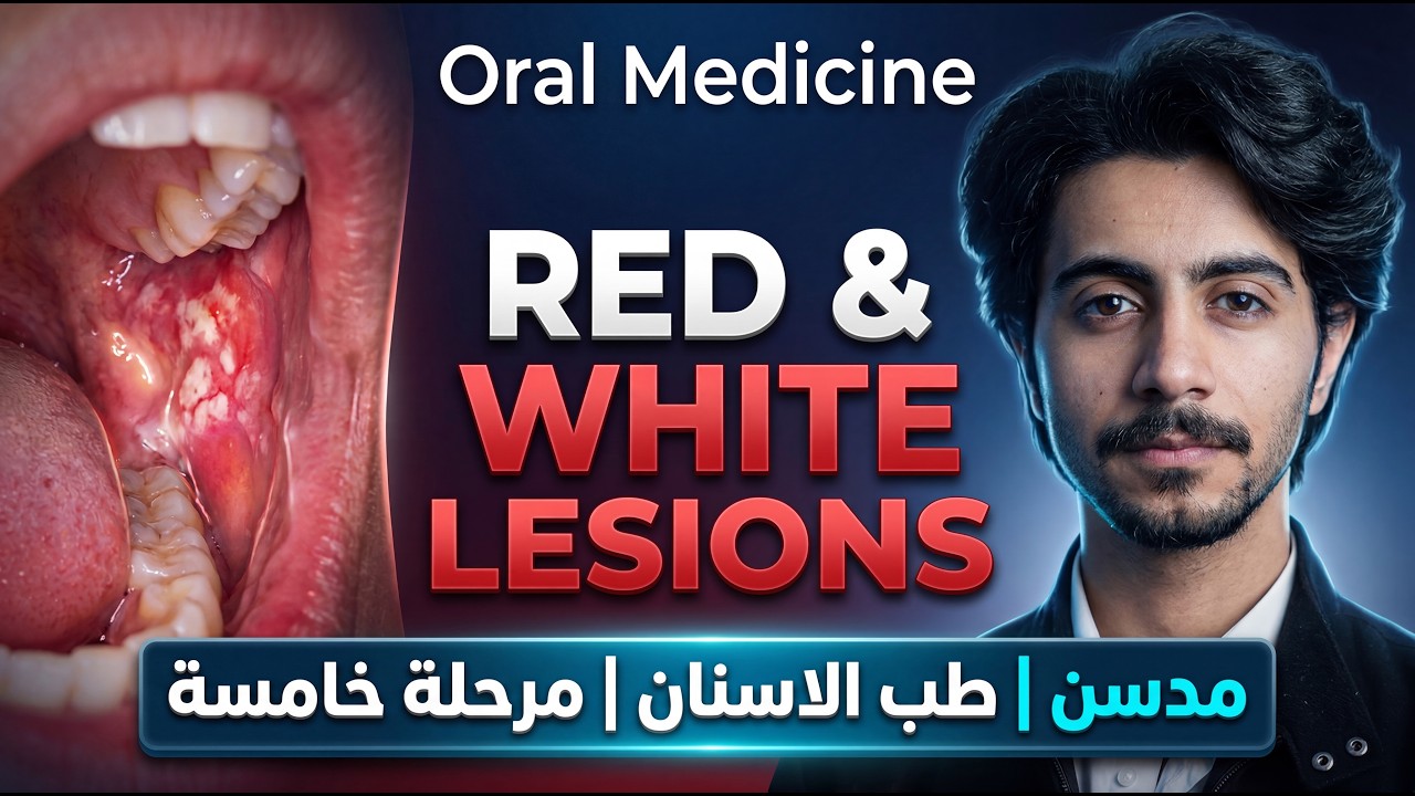 شرح مدسن مرحلة خامسة طب اسنان وزاري - Red and White Lesions P.1